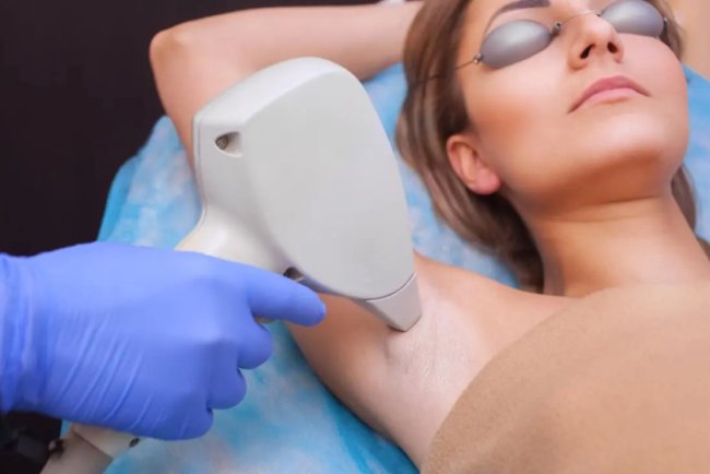 Laser Hair Removal: Everything You Need to Know