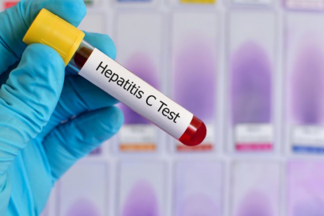 Hepatitis C Unveiled: Risks, Prevention, and Modern Treatment Methods