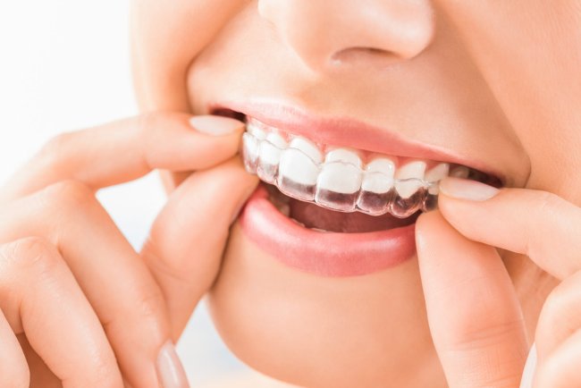 Find Nearby Dentists for Invisalign and Teeth Gap Treatments