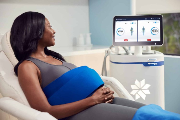 CoolSculpting: A New Choice for Fat Reduction