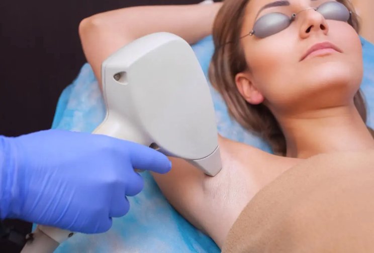 Laser Hair Removal: Everything You Need to Know