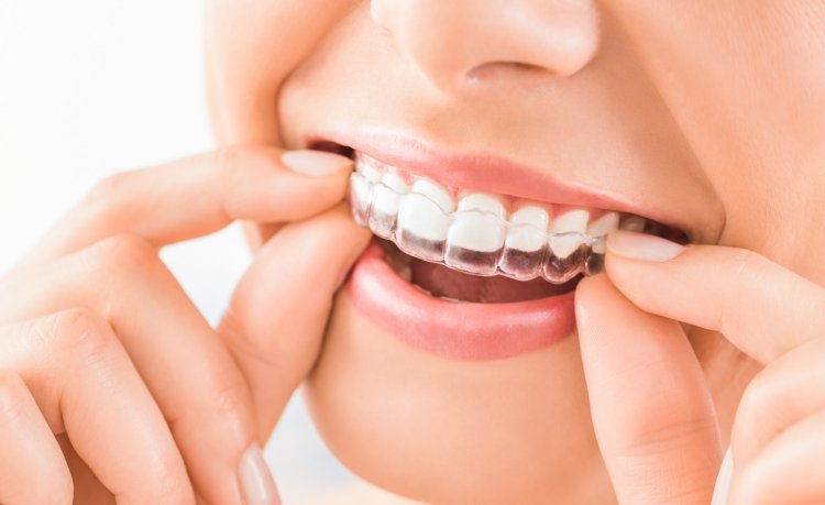 Find Nearby Dentists for Invisalign and Teeth Gap Treatments
