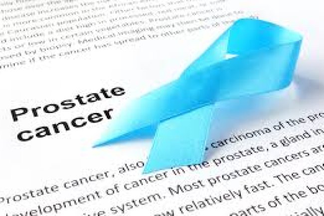 Comprehensive Prostate Cancer Guide: Everything You Need to Know