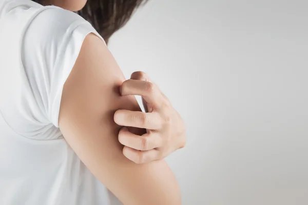 Effective Strategies to Get Rid of Eczema Itching
